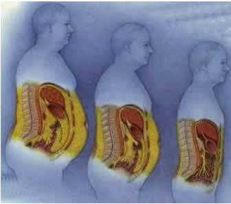 Three successive images of a man's torso displays the effect of body weight on the internal organs.