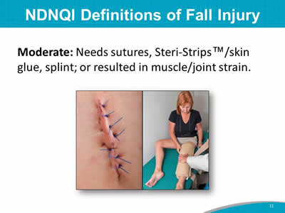 NDNQI Definitions of Fall Injury